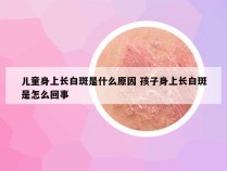 儿童身上长白斑是什么原因 孩子身上长白斑是怎么回事