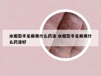 水疱型手足癣用什么药涂 水疱型手足癣用什么药涂好