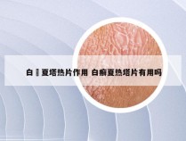 白廯夏塔热片作用 白癣夏热塔片有用吗