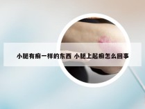 小腿有癣一样的东西 小腿上起癣怎么回事