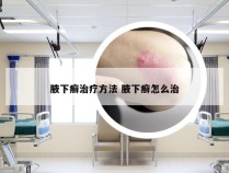 腋下癣治疗方法 腋下癣怎么治