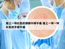 腿上一块红色的像癣不痒不痛 腿上一块一块红色的不痒不痛