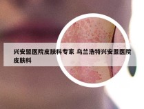 兴安盟医院皮肤科专家 乌兰浩特兴安盟医院皮肤科