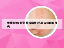 维胺酯维e乳膏 维胺酯维e乳膏去痘印有用吗