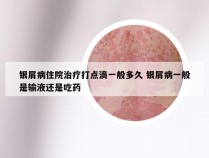 银屑病住院治疗打点滴一般多久 银屑病一般是输液还是吃药