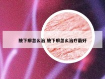 腋下癣怎么治 腋下癣怎么治疗最好