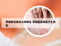 掌指脓包病怎么样根治 掌指脓包病是什么意思