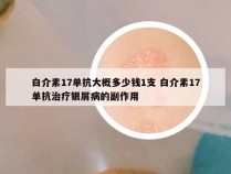 白介素17单抗大概多少钱1支 白介素17单抗治疗银屑病的副作用