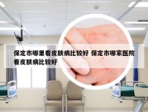 保定市哪里看皮肤病比较好 保定市哪家医院看皮肤病比较好