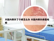 大腿内侧长了个癣怎么办 大腿内侧长癣是啥癣