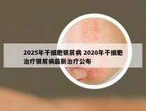 2025年干细胞银屑病 2020年干细胞治疗银屑病最新治疗公布