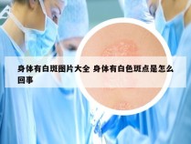 身体有白斑图片大全 身体有白色斑点是怎么回事