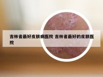 吉林省最好皮肤病医院 吉林省最好的皮肤医院