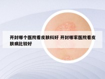 开封哪个医院看皮肤科好 开封哪家医院看皮肤病比较好