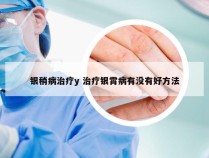 银稍病治疗y 治疗银霄病有没有好方法