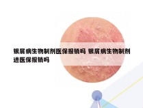 银屑病生物制剂医保报销吗 银屑病生物制剂进医保报销吗