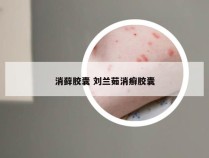 消藓胶囊 刘兰茹消癣胶囊