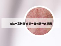 皮肤一直长藓 皮肤一直长藓什么原因