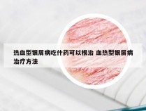 热血型银屑病吃什药可以根治 血热型银屑病治疗方法