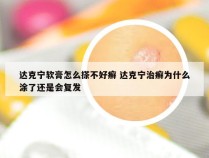 达克宁软膏怎么搽不好癣 达克宁治癣为什么涂了还是会复发