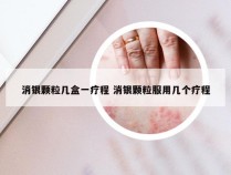 消银颗粒几盒一疗程 消银颗粒服用几个疗程