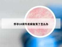 怀孕10周牛皮癣复发了怎么办