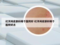 红河州皮肤科哪个医院好 红河州皮肤科哪个医院好点