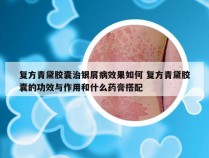 复方青黛胶囊治银屑病效果如何 复方青黛胶囊的功效与作用和什么药膏搭配