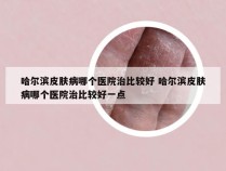 哈尔滨皮肤病哪个医院治比较好 哈尔滨皮肤病哪个医院治比较好一点