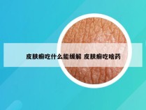 皮肤癣吃什么能缓解 皮肤癣吃啥药