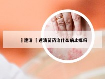 廯速清 廯速清苗药治什么病止痒吗