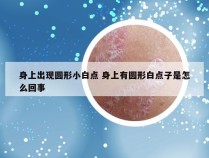 身上出现圆形小白点 身上有圆形白点子是怎么回事