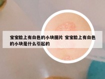 宝宝脸上有白色的小块图片 宝宝脸上有白色的小块是什么引起的