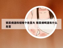 银屑病酒和烟哪个危害大 银屑病喝酒有什么危害