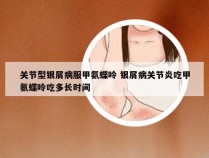 关节型银屑病服甲氨蝶呤 银屑病关节炎吃甲氨蝶呤吃多长时间