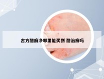 古方醋癣净哪里能买到 醋治癣吗