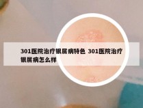 301医院治疗银屑病特色 301医院治疗银屑病怎么样