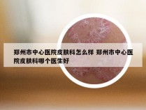 郑州市中心医院皮肤科怎么样 郑州市中心医院皮肤科哪个医生好