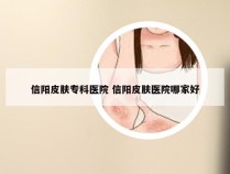 信阳皮肤专科医院 信阳皮肤医院哪家好