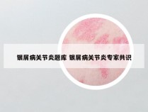 银屑病关节炎题库 银屑病关节炎专家共识