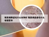 银屑病脾虚吃什么食物好 银屑病患者吃什么增强营养