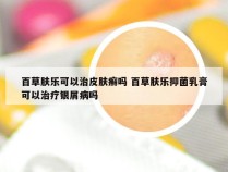 百草肤乐可以治皮肤癣吗 百草肤乐抑菌乳膏可以治疗银屑病吗