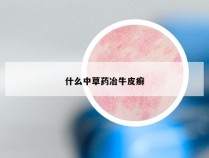 什么中草药冶牛皮癣