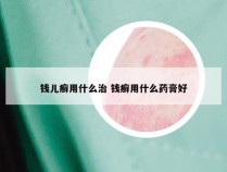 钱儿癣用什么治 钱癣用什么药膏好