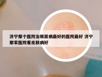 济宁那个医院治银屑病最好的医院最好 济宁那家医院看皮肤病好