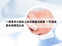 一周多岁小孩头上长头癣是怎回事 一岁宝宝有头皮癣怎么办