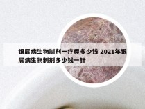 银屑病生物制剂一疗程多少钱 2021年银屑病生物制剂多少钱一针