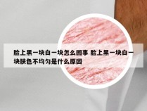 脸上黑一块白一块怎么回事 脸上黑一块白一块肤色不均匀是什么原因