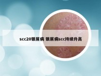 scc20银屑病 银屑病scc持续升高