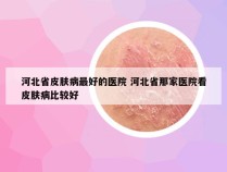 河北省皮肤病最好的医院 河北省那家医院看皮肤病比较好